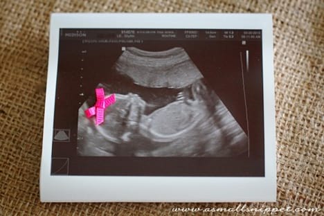 A baby ultrasound photo adorned with a pink bow